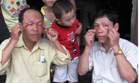 "Kỳ nhân dị sĩ" ăn ớt như rau, chà ớt vào mắt vẫn bình thản, bí ẩn phía sau gây sốc