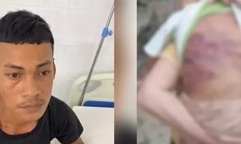 Lời khai của gã cha dượng trong vụ bé trai 2 tuổi bị bạo hành đến nguy kịch