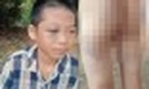 Chi tiết cực đắt trong vụ bé lớp 6 nghi bị mẹ kế và cha bạo hành: Chúng ta cần nhìn lại để dạy con mình!