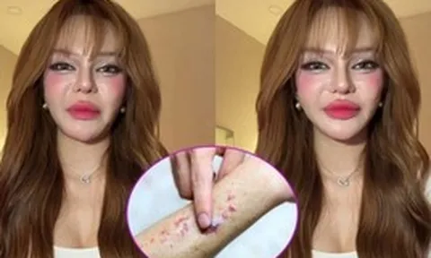 Video lúc nửa đêm của TikToker 11 triệu người theo dõi khiến nhiều người giật mình: Ung thư máu có đến từ thói quen thức khuya, uống trà sữa?