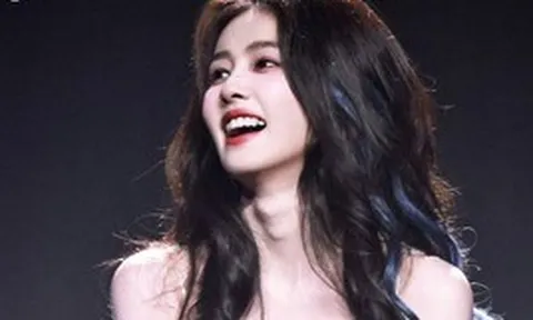 Mỹ nhân có nụ cười vô duyên nhất showbiz không biết xấu hổ à?