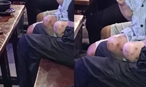 Bé gái xuất hiện tại quán "bar beer" ở Hà Nội với nhiều dấu hiệu bất thường: Kết quả xác minh