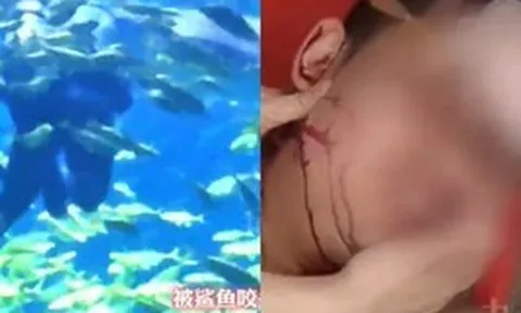 Du khách đi lặn bị cá mập cắn vào đầu, nhân viên vẫn hỏi “có muốn tiếp tục không?”