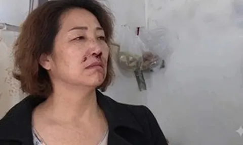 Người phụ nữ bị con trai đấm gãy mũi vì bế cháu khi chưa rửa tay, 6 năm sau cuộc sống của họ ra sao?