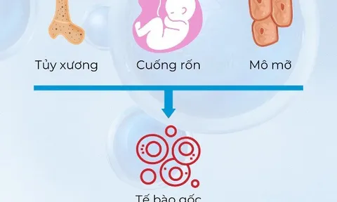 Điều trị bệnh ALS bằng tế bào gốc trung mô